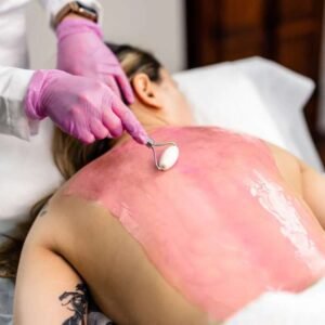 Back facial (facial de espalda)