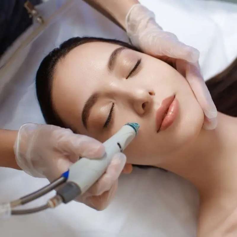 Hydrodermabrasion facial