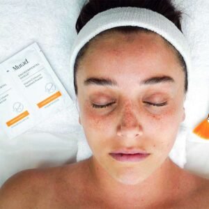 Vital C infusión facial